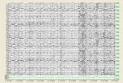 Screenshot of PRANA in Quantitative EEG
